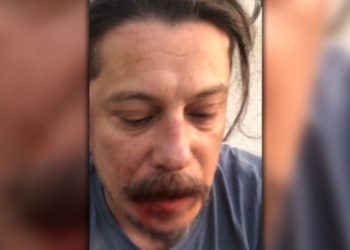 Γερμανία: Θύμα άγριας επίθεσης Τούρκος δημοσιογράφος επικριτής του Ερντογάν