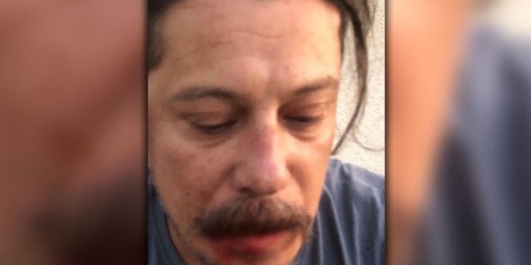 Γερμανία: Θύμα άγριας επίθεσης Τούρκος δημοσιογράφος επικριτής του Ερντογάν