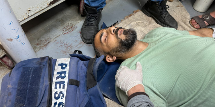 Γάζα: Δημοσιογράφος του τουρκικού δικτύου TRT τραυματίστηκε σοβαρά από ισραηλινό βομβαρδισμό